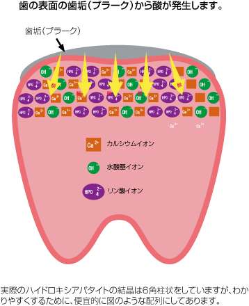 脱灰・再石灰化01