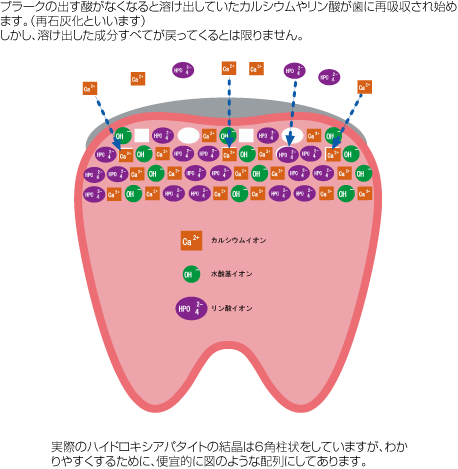 脱灰・再石灰化04